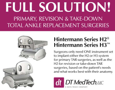 Hintegra Total Ankle Replacement